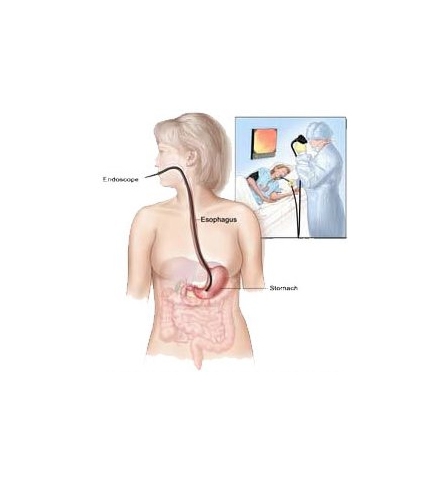 Gastroclinica - Exame - Endoscopia Digestiva Alta